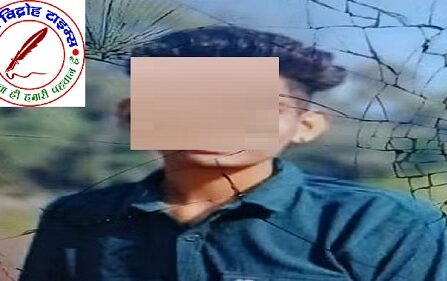 संदिग्ध हालात में 96% से अधिक झुलसे युवक की मौत !