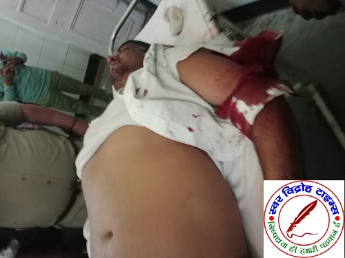 बेखौफ अपराधियों ने पत्रकार को दिनदहाड़े मारी गोली !