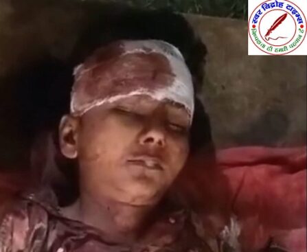 निचलौल में 14 साल के बच्चे की संदिग्ध परिस्थितियों में मौत ! पड़ोसी के घर से मिला खून से लतपथ, सिर पर गंभीर चोट के निशान !