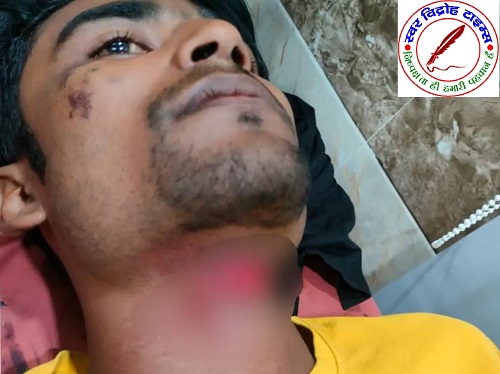 साली की शादी में जीजा ने किया हंगामा ! पत्नी को साथ ले जाने की जिद में युवक ने गला रेत कर खुद को किया घायल !