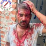 दुकान के अंदर से कूड़ा नहीं उठाने पर मनबढ़ो ने नगर निगम कर्मी का सिर फोड़ा !