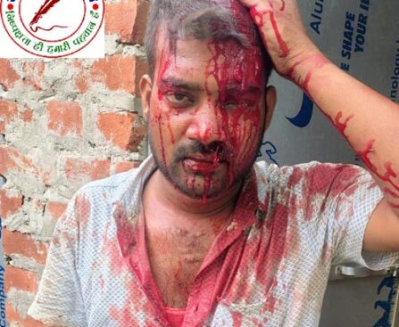 दुकान के अंदर से कूड़ा नहीं उठाने पर मनबढ़ो ने नगर निगम कर्मी का सिर फोड़ा !