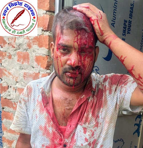 दुकान के अंदर से कूड़ा नहीं उठाने पर मनबढ़ो ने नगर निगम कर्मी का सिर फोड़ा !